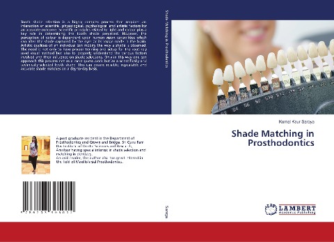 Shade Matching in Prosthodontics