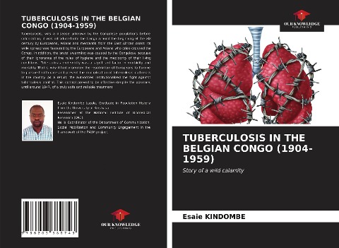 TUBERCULOSIS IN THE BELGIAN CONGO (1904-1959): Story of a wild calamity