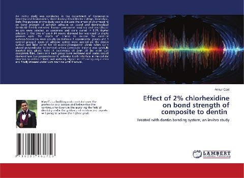 Effect of 2% chlorhexidine on bond strength of composite to dentin: Treated with dentin bonding system; an invitro study