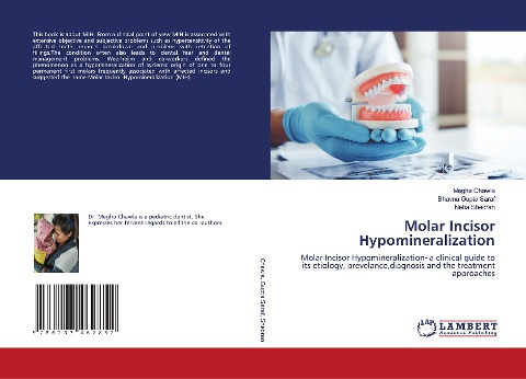 Molar Incisor Hypomineralization: Molar Incisor Hypomineralization- a clinical guide to its etiology, prevelance,diagnosis and the treatment approaches