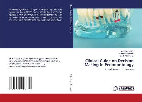 Clinical Guide on Decision Making In Periodontology: A Quick Review Of Literature