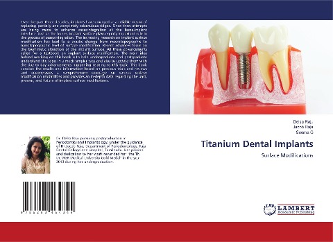 Titanium Dental Implants: Surface Modifications