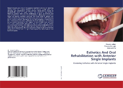 Esthetics And Oral Rehabilitation with Anterior Single Implants: Mastering Esthetics with Anterior Single Implants
