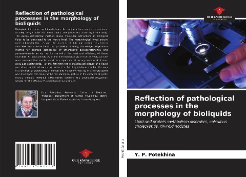 Reflection of pathological processes in the morphology of bioliquids: Lipid and protein metabolism disorders, calculous cholecystitis, thyroid nodules
