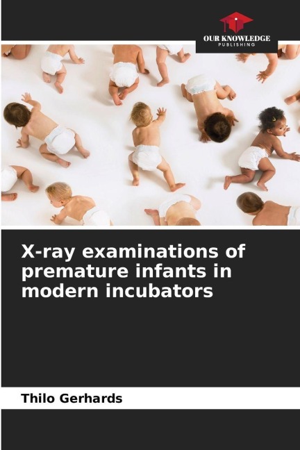 X-ray examinations of premature infants in modern incubators