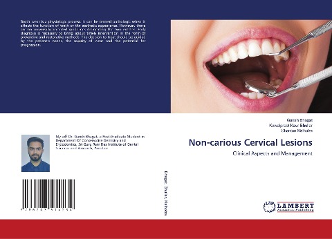 Non-carious Cervical Lesions: Clinical Aspects and Management