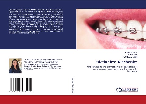 Frictionless Mechanics: Understanding the biomechanics of space closure using various loops for efficient orthodontic treatment