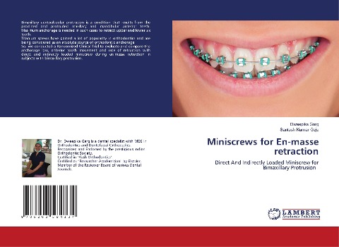Miniscrews for En-masse retraction: Direct And Indirectly Loaded Miniscrew for Bimaxillary Protrusion