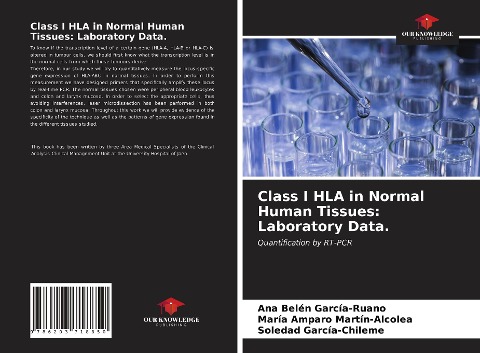 Class I HLA in Normal Human Tissues: Laboratory Data.: Quantification by RT-PCR