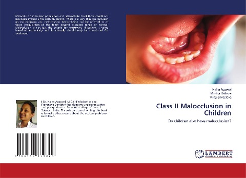 Class II Malocclusion in Children: Do children also have malocclusion?