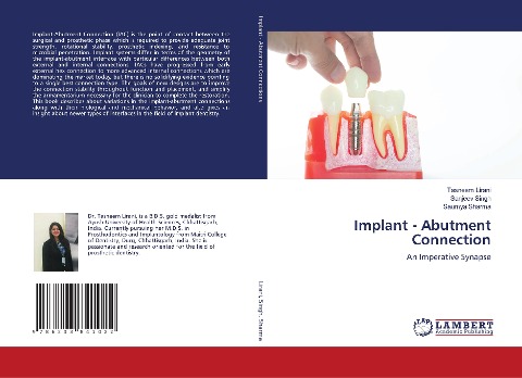 Implant - Abutment Connection: An Imperative Synapse