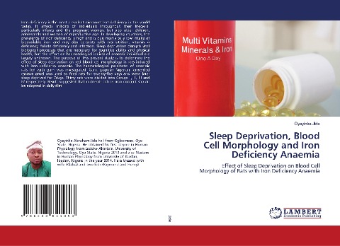 Sleep Deprivation, Blood Cell Morphology and Iron Deficiency Anaemia: Effect of Sleep Deprivation on Blood Cell Morphology of Rats with Iron Deficiency Anaemia