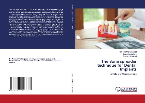 The Bone spreader technique for Dental Implants: simple Graftless solutions