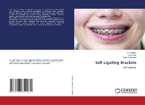 Self Ligating Brackets: Self Ligating