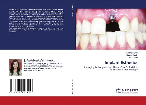 Implant Esthetics: Managing Peri-implant Soft Tissue - The Critical Link To Success In Implantology