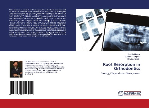 Root Resorption in Orthodontics: Etiology, Diagnosis and Management