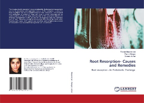 Root Resorption- Causes and Remedies: Root resorption - An Endodontic Challenge