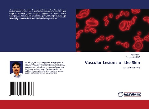 Vascular Lesions of the Skin: Vascular Lesions