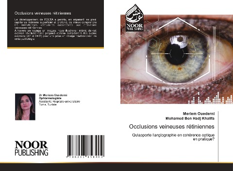 Occlusions veineuses rétiniennes: Quapporte langiographie en cohérence optique en pratique?