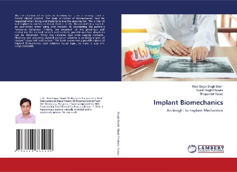 Implant Biomechanics: An insight to Implant Mechanism