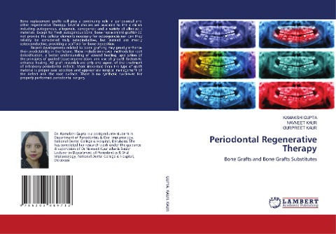 Periodontal Regenerative Therapy: Bone Grafts and Bone Grafts Substitutes