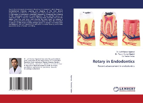 Rotary in Endodontics: Recent advancement in endodontics