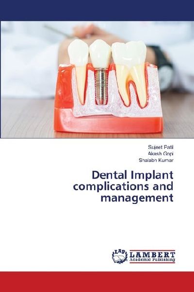 Dental Implant complications and management