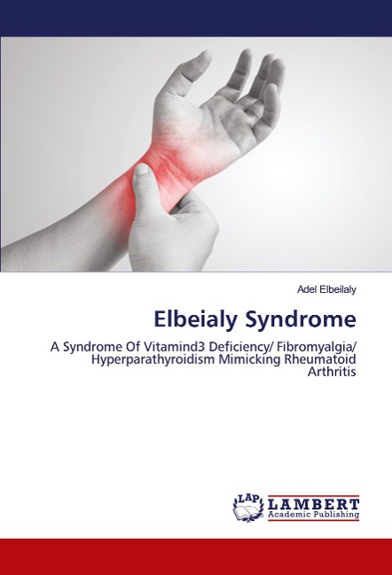 Elbeialy Syndrome: A Syndrome Of Vitamind3 Deficiency/ Fibromyalgia/ Hyperparathyroidism Mimicking Rheumatoid Arthritis