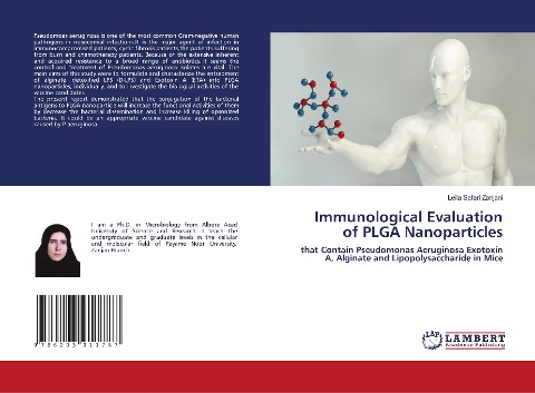 Immunological Evaluation of PLGA Nanoparticles: that Contain Pseudomonas Aeruginosa Exotoxin A, Alginate and Lipopolysaccharide in Mice