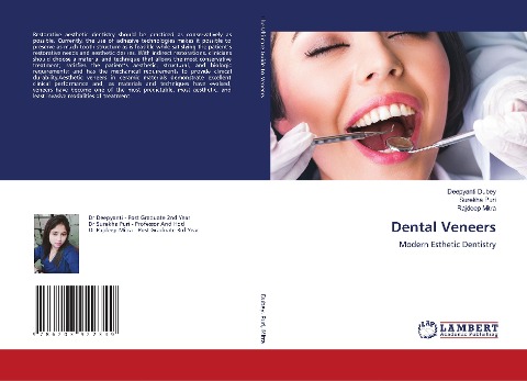 Dental Veneers: Modern Esthetic Dentistry
