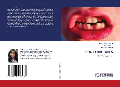 ROOT FRACTURES: & Its Management