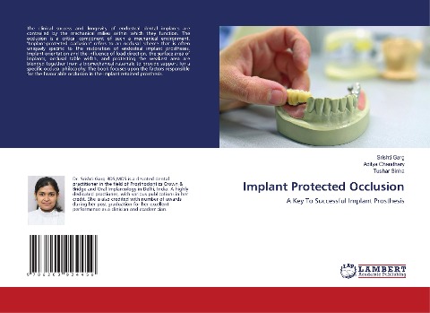 Implant Protected Occlusion: A Key To Successful Implant Prosthesis