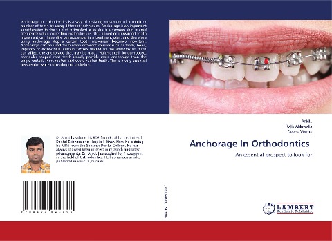 Anchorage In Orthodontics: An essential prospect to look for