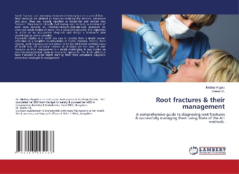 Root fractures & their management: A comprehensive guide to diagnosing root fractures & successfully managing them using State of the Art methods.
