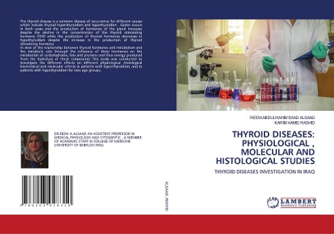 THYROID DISEASES: PHYSIOLOGICAL , MOLECULAR AND HISTOLOGICAL STUDIES: THYROID DISEASES INVESTIGATION IN IRAQ
