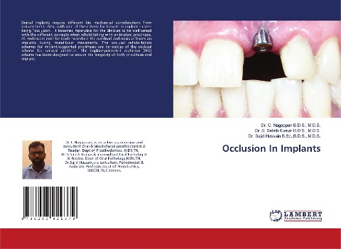 Occlusion In Implants