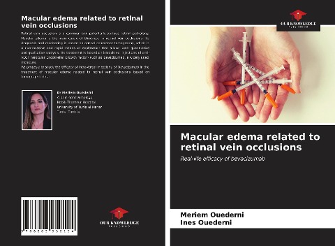 Macular edema related to retinal vein occlusions: Real-life efficacy of bevacizumab