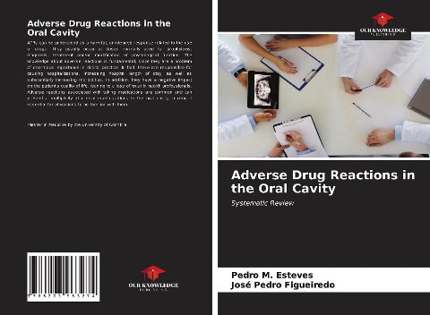 Adverse Drug Reactions in the Oral Cavity: Systematic Review