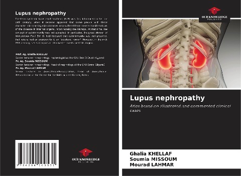 Lupus nephropathy: Atlas based on illustrated and commented clinical cases
