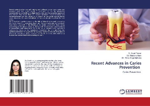 Recent Advances in Caries Prevention: Caries Prevention