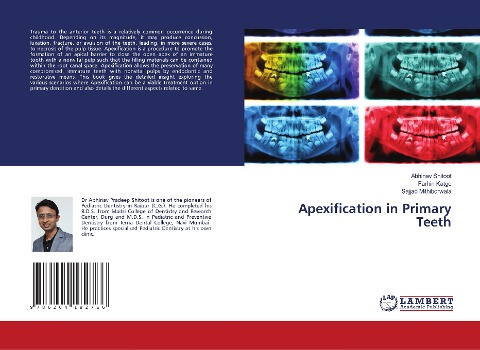 Apexification in Primary Teeth