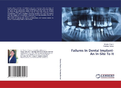 Failures In Dental Implant- An In-Site To It