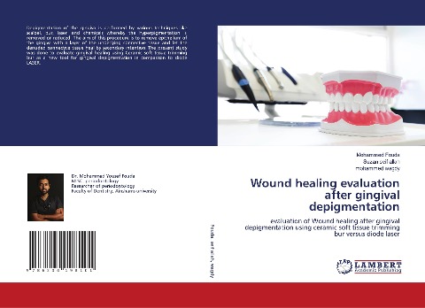 Wound healing evaluation after gingival depigmentation: evaluation of Wound healing after gingival depigmentation using ceramic soft tissue trimming bur versus diode laser