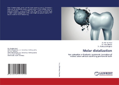 Molar distalization: Non-extraction orthodontic treatment: Correction of malocclusion without sacrificing permanent teeth