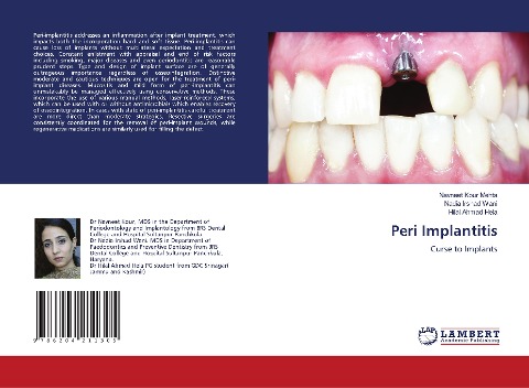 Peri Implantitis: Curse to Implants