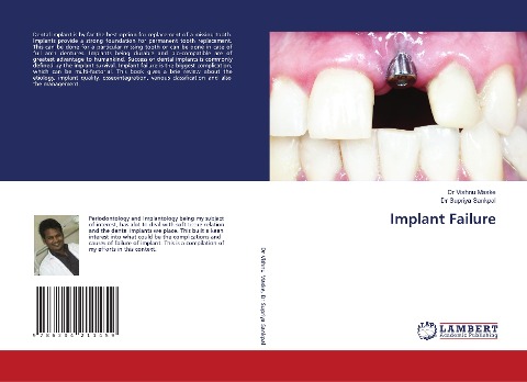 Implant Failure