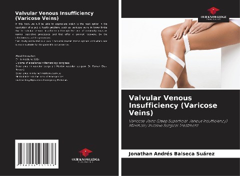 Valvular Venous Insufficiency (Varicose Veins): Varicose Veins (Deep Superficial Venous Insufficiency) Minimally Invasive Surgical Treatment