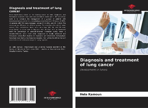 Diagnosis and treatment of lung cancer: Developments in Tunisia