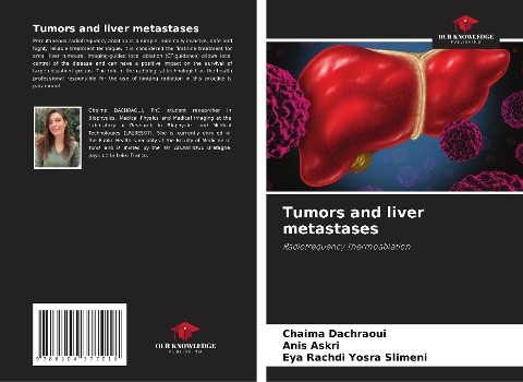 Tumors and liver metastases: Radiofrequency Thermoablation