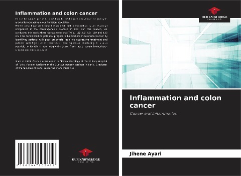 Inflammation and colon cancer: Cancer and inflammation